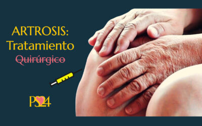 Tratamiento no quirúrgico de la Artrosis.
