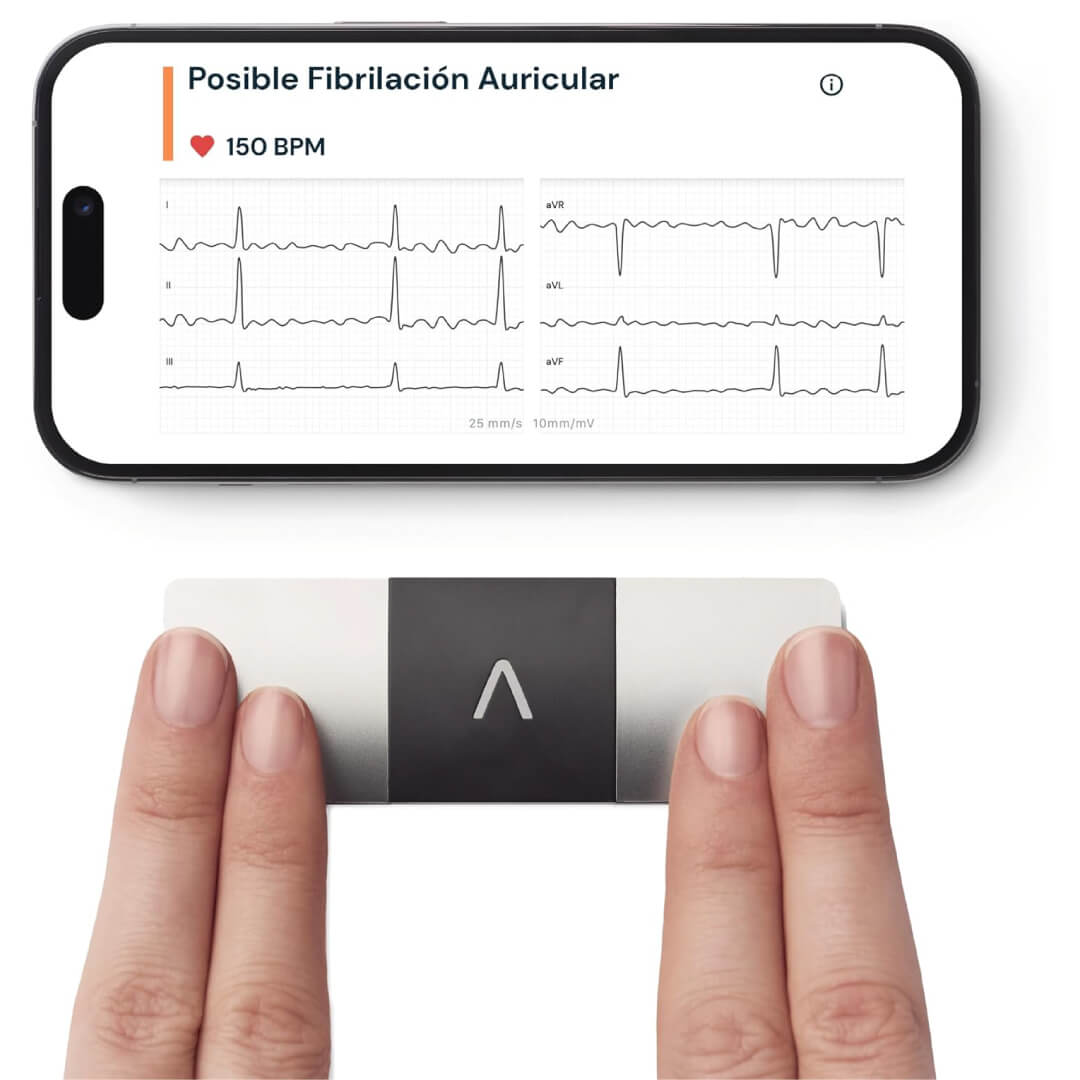 kardia-electrocardiograma-6-derivaciones